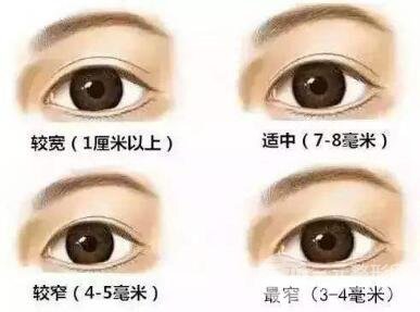 全體仙女注意：做雙眼皮修復(fù)注意這幾點(diǎn)不踩雷！