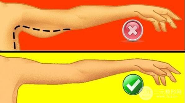 抽脂以后注意事項