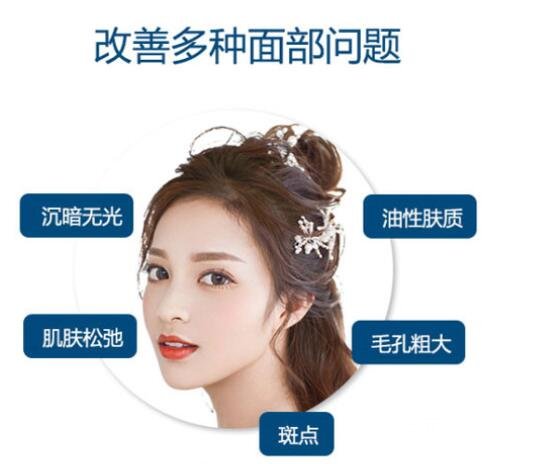 秒激光祛斑容易反彈嗎?