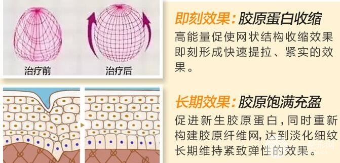 熱瑪吉第三代的果不好？看了圖片可能會(huì)打臉！