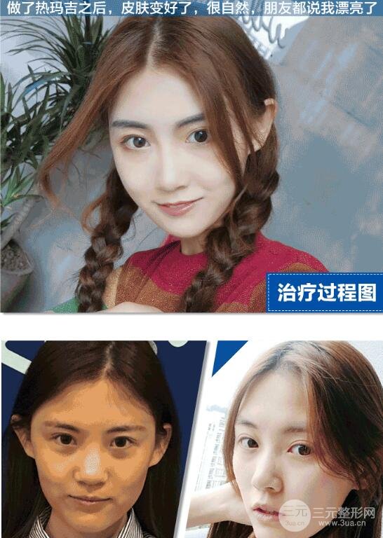 熱瑪吉第三代的果不好？看了圖片可能會(huì)打臉！