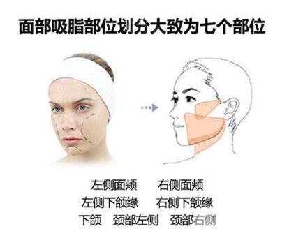 光纖溶脂瘦臉是長(zhǎng)時(shí)間的嗎？維持時(shí)間是多長(zhǎng)？