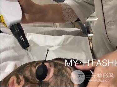 黑臉娃娃費(fèi)用