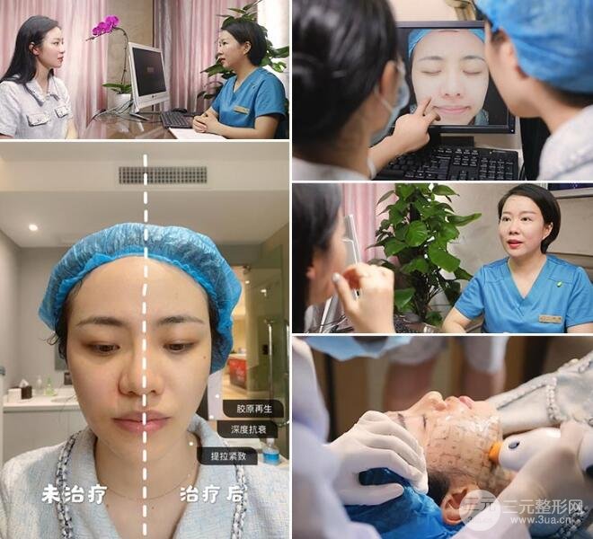 熱瑪吉緊膚果圖