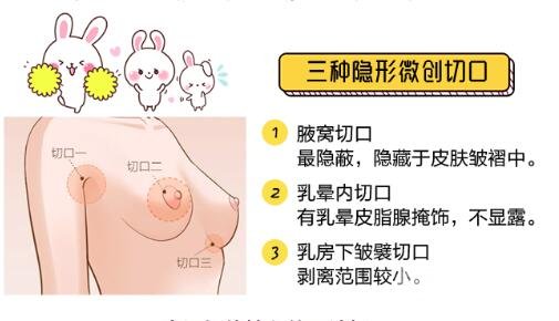 隆胸假體選擇注意事項(xiàng)