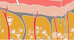 吸脂塑型手術(shù)能做哪些部位？讓你又瘦又美，好身材~