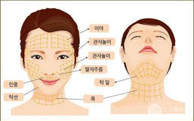 韓國(guó)面部除皺手術(shù)火到爆，帶你了解一下這個(gè)抗衰手術(shù)~