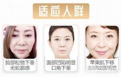 拉皮除皺術(shù)能保持幾年：永遠(yuǎn)勝過(guò)同齡人~