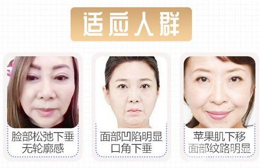 拉皮除皺術能保持幾年