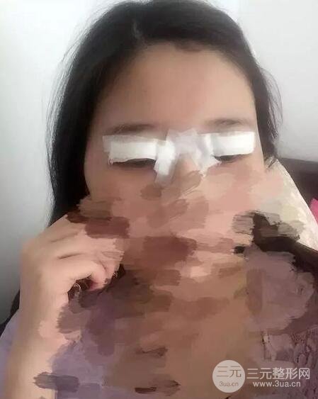 新星靚劉風卓眼修復(fù)