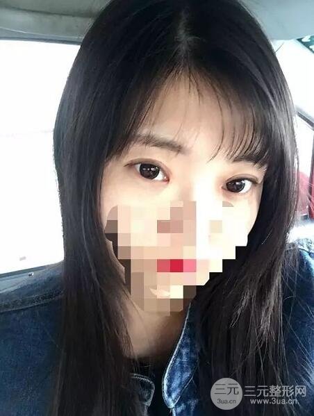 新星靚劉風卓眼修復(fù)