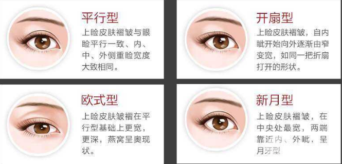 微創(chuàng)雙眼皮多少錢