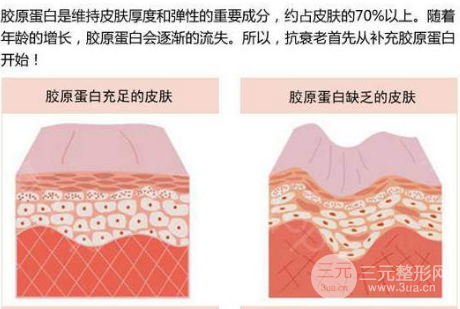 臉部哪些部位可以注射膠原蛋白美容