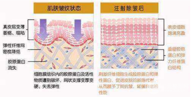 臉部哪些部位可以注射膠原蛋白美容