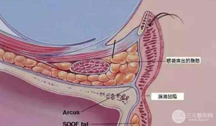 玻尿酸填淚溝隔多久打一次？
