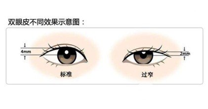 雙眼皮手術修復醫(yī)院