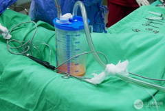 威塑吸脂vaser國(guó)內(nèi)哪里有？哪里可以做？