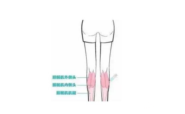 注射瘦臉注射瘦腿果維持時(shí)間