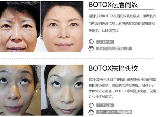 注射****注射瘦臉注意