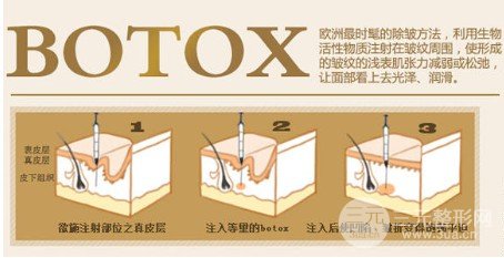 注射除皺到底好不好