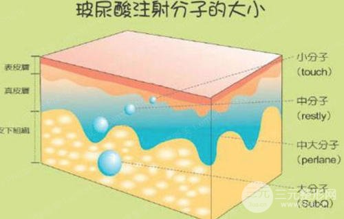 玻尿酸一支多少錢