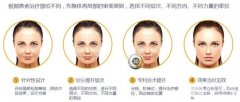 面部除皺術(shù)價(jià)格貴嗎？多少錢？哪種果好？