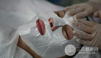 果酸換膚要多少錢