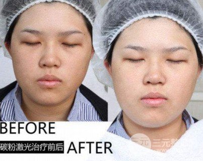 做黑臉娃娃嫩膚是什么感覺(jué)