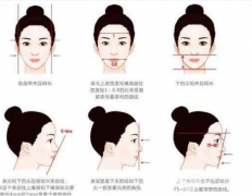 自體脂肪豐下巴果怎么樣？自然嗎？