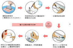 自體細胞注射降低風險嗎？360度科普醫(yī)美技術(shù)