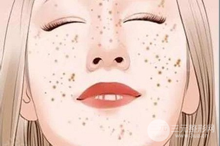 激光去黃褐斑多少錢