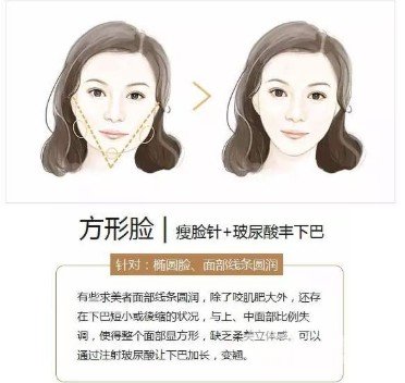 玻尿酸豐下巴價(jià)格