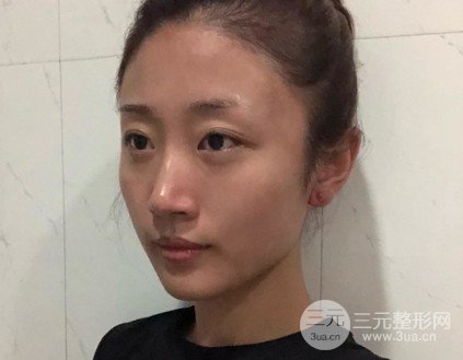 白瓷娃娃祛斑果怎么樣