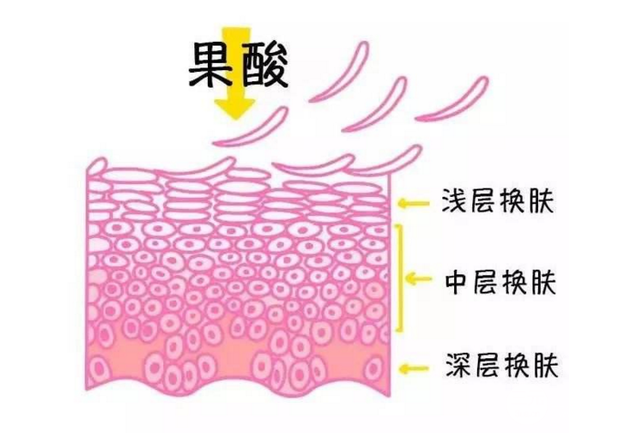 果酸嫩膚是怎么做的