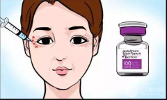 眼部注射去皺玻尿酸還是rd素？