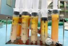 svf脂肪膠填充技術(shù)果圖，基本功能和果解讀