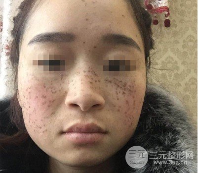 黑臉娃娃是什么