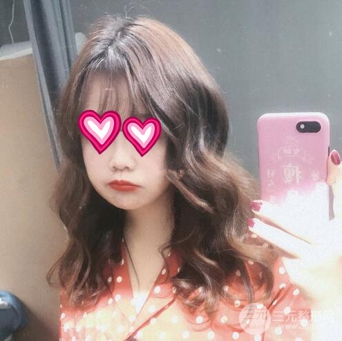 注射瘦臉瘦臉果圖