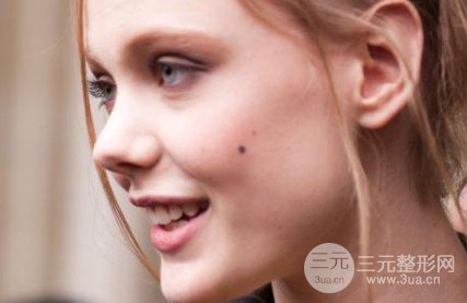 冷光美白牙齒的價格