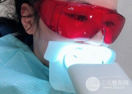 冷光美白牙齒的價格