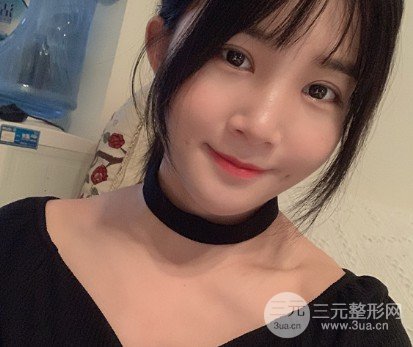 吳慧玲雙眼皮修復(fù)經(jīng)歷