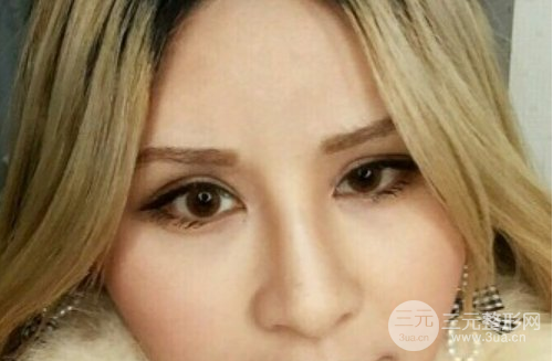 芭比眼睛雙眼皮圖片