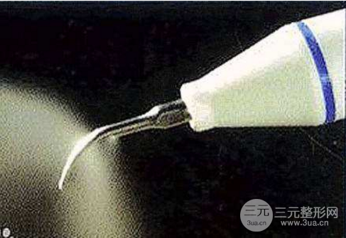 超聲波潔牙多少錢