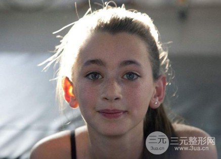 激光祛除黃褐斑會復發(fā)嗎