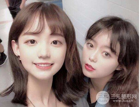 眼角開(kāi)大整形手術(shù)