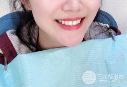 冷光美白牙齒好不好