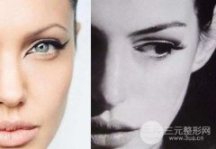 玻尿酸隆鼻到底能保持多久?副作用及注射流程指南