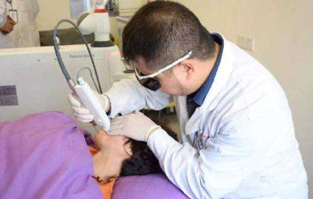 激光可以去除黃褐斑嗎