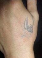 洗紋身事項(xiàng)問(wèn)與答：