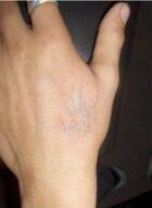 洗紋身事項(xiàng)問(wèn)與答：